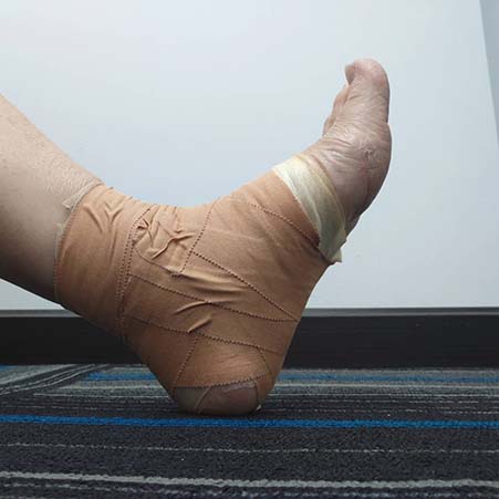 Ankle Taping – Rathmines Physiotherapy and Sports Injury Centre